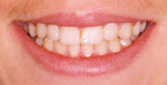 Tratament ortodontic